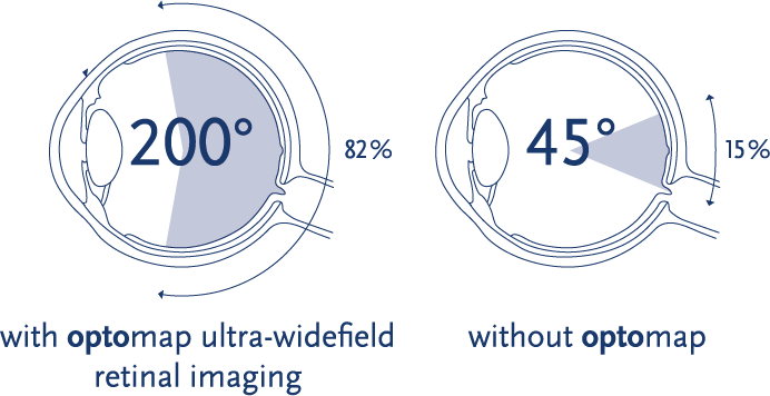 optomap comparison graphic